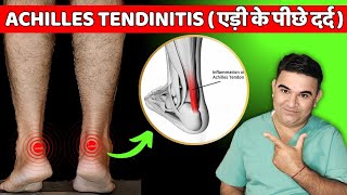 Home Treatment Plan for Achilles Tendinitis [upl. by Mohorva121]