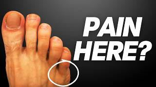 Pinky Toe Pain  4 Causes of Little Toe Pain and Tips To Treat Them [upl. by Latea]