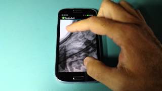 DICOMHERO DICOM SDK for Android test app [upl. by Alleda]