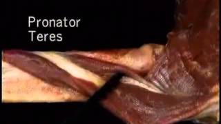 pronator teres muscle [upl. by Irrol]