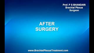 Erbs Palsy Right Surgery [upl. by Corty]