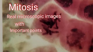 Mitosis  Real microscope image cell division with important points [upl. by Nica348]