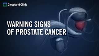 10 Warning Signs of Prostate Cancer [upl. by Ivett]