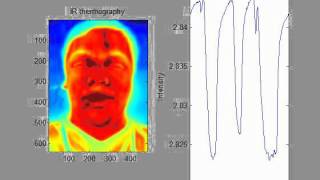 Contactless respiration measurement [upl. by Ru203]