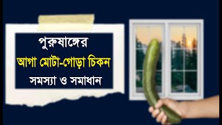 আগা মোটা গোড়া চিকন ও একটু বাঁকা সমাধান যেনে নিন। [upl. by Gingras]