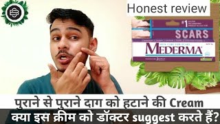 Mederma cream review  दाग मिटाने की सबसे अच्छी क्रीम  Mederma cream  mederma scars cream [upl. by Sucramat534]