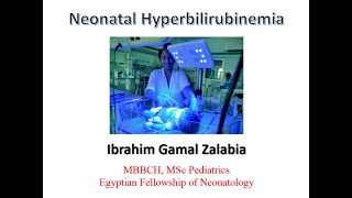 New guidelines for treatment of neonatal hyperbilirubinemia [upl. by Bazar]