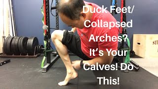 Duck FeetCollapsed Arches RunningSquatting Problems It’s Your Calves Do This  Dr Wil amp Dr K [upl. by Alita]