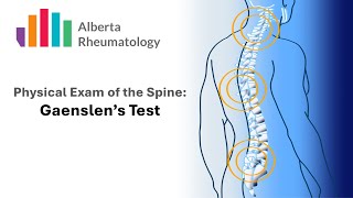 Rheumatology BACK exam Gaenslens Test [upl. by Kimberli]