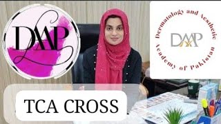 TCA CROSS Acne Scars Treatment by Dr Sadia Cheema Dermatologist  DAAP Aesthetics [upl. by Ylrac152]