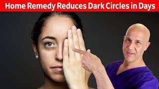 Home Remedy Reduces Dark Eye CirclesResults in Days Dr Mandell [upl. by Hadihahs]