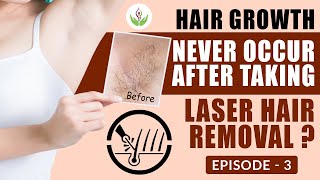 Does Hair Growth Never Occur After Laser Hair Removal  Episode  3  Care Well Medical Centre [upl. by Janene]