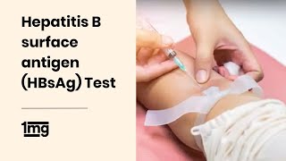 Hepatitis B surface antigen HBsAg Test  1mg [upl. by Underwood]