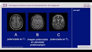 23 CONSEJOS PRACTICOS PARA LA INTERPRETACIÓN DE IMÁGENES [upl. by Drofdarb]