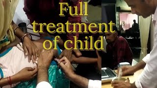 How are treatment of child in high fever patient ko high temperature mai treatment kaise de🩺💊💉💉💉 [upl. by Davidde330]