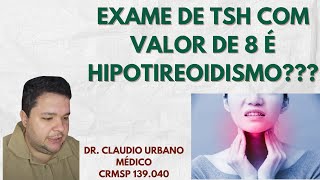 Hipotiroidismo Subclínico Sintomas Causas e Tratamentos Perguntas e Respostas com médico [upl. by Loleta]