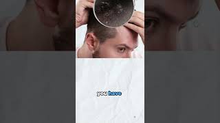 Losing hair during crust removal after hair transplant Is it Normal  Explained by Dr Jangid [upl. by Yorgen331]