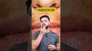 Pigmentation Around Mouth Skincare Routine for Glowing Skin [upl. by Moule396]