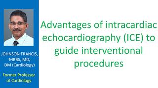 Advantages of intracardiac echocardiography to guide interventional procedures [upl. by Fairman125]