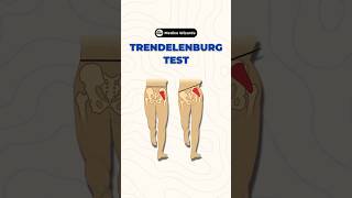 Understanding the Trendelenburg Test A key assessment for hip stability amp gluteal muscle function [upl. by Hesler650]