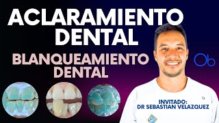 Aclaramiento Dental 🦷 Blanqueamiento Dental con Dr Sebastian Velazquez [upl. by Elna890]