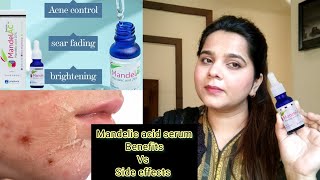 How to use Mandelic acid serum  mandelic acid serum review [upl. by Aziaf]