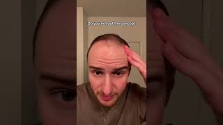 Do you not get the concept hair hairtransformation hairgrowth [upl. by Ococ]