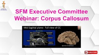 SFM Executive Committee Webinar Corpus Callosum [upl. by Ariday]