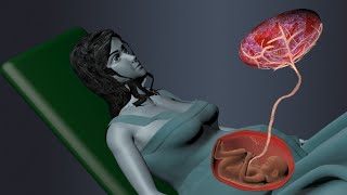 Fertilization Development of Placenta Labor and Delivery 3D Animation [upl. by Ithaman]