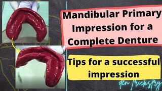 Mandibular Primary Impression for an Edentulous Patient Complete Denture Impression [upl. by Lipp]