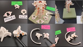 Vertebrae Anatomy  Cervical vs Thoracic vs Lumbar   Atlas vs Axis  Vertebral Column [upl. by Francklin188]