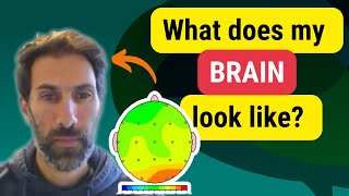 Inside the Autistic Brain – THE RESULTS ARE IN [upl. by Eelymmij]