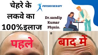 Bells palsy physiotherapy mohaniya kaimurdistrict facial exercises [upl. by Anomas]