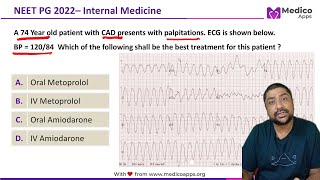 NEET PG Recall 2022 Sustained Monomorphic Ventricular Tachycardia Internal Medicine [upl. by Aihsotal]