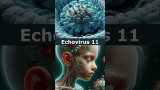 🦠 Echovirus 11🦠 [upl. by Leuqram]