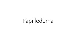 Papilledema  Ophthalmology [upl. by Olegnaleahcim]