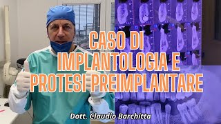 IMPLANTOLOGIA E ORTODONZIA PREINPLANTARE  Dott Claudio Barchitta [upl. by Ahsauqram]