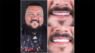 Charlie Sloth DJ  Attelia Dental Turkey [upl. by Abbot310]