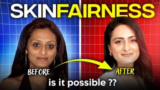 Fairness cream  Do they work  How to lighten skin tone  Dermatologist [upl. by Taub]