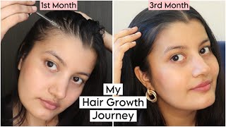 My 3 Months Experience of Using the Advanced Hair Growth serum [upl. by Simmonds]