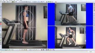 Running gait analysis Anteriorposterior pelvic tiltingwmv [upl. by Noram393]