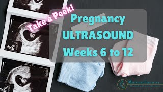 Take a Peek Weeks 6 to 12 in Pregnancy Scans  Ultrasounds [upl. by Trow]