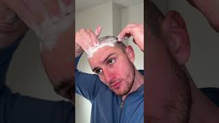 Keep falling in love hair hairtransformation hairtransplant hairwashday update buzzcut [upl. by Nrubua]