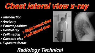 Chest Lateral view Xray  Right amp Left lateral projection  Chest radiography  By BL Kumawat [upl. by Pip343]