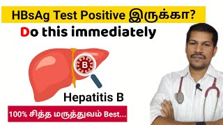 HBsAg Positive what to do next HBsAg hepatitis hbv drmerish hbsagtest [upl. by Lance]