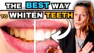 The BEST Way to Whiten Your Teeth without ruining them [upl. by Goat654]