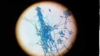 epidermophyton floccosum structure under 45x compound microscope [upl. by Einobe]