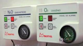 Sedação Leve com Óxido Nitroso Hospital Odontológico CIR Premier [upl. by Millar773]