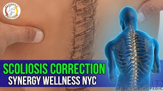 Scoliosis Correction  Synergy Wellness NYC chiropractors Specialty [upl. by Mouldon456]