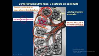 syndrome interstitiel en détails 01 [upl. by Breed138]